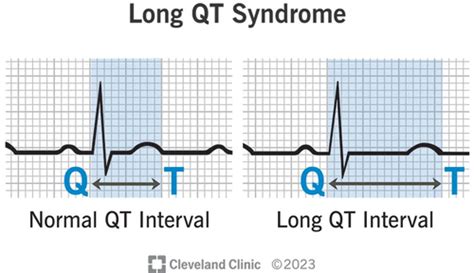 how many months does xray last|How long is the interval between 2 x.